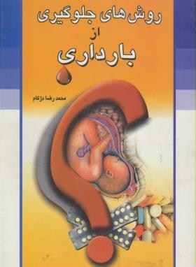 روش های جلوگیری ازبارداری(محمدرضادژکام/منشاءدانش)
